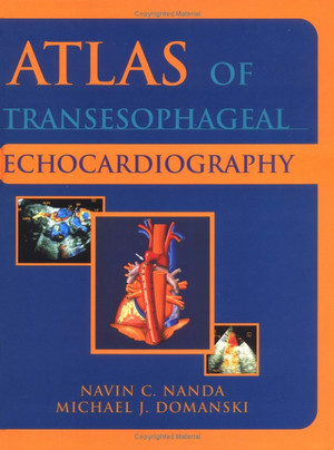 Atlas Siêu âm Tim qua Thực quản 2e