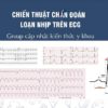 [A5] Chiến thuật chẩn đoán loạn nhịp trên ECG