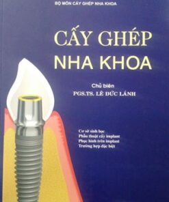 [A5] Cấy ghép nha khoa