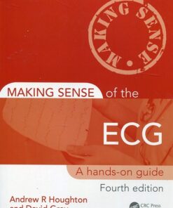 [A5] Making sense of the ECG
