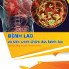 [Gốc] Bệnh Lao Và Tiến Trình Chấm Dứt Bệnh Lao - HN 2022 - Cuốn