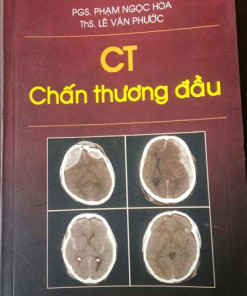 [Gốc] CT Chấn Thương Đầu - Cuốn