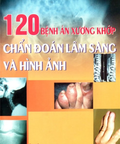 [Gốc] 120 Bệnh Án Xương Khớp, Chẩn Đoán Lâm Sàng Và Hình Ảnh - 2007 - Cuốn