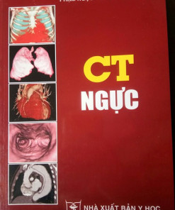 [Gốc] CT Ngực (PNH) - Cuốn